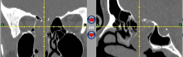 Image Guided Surgery